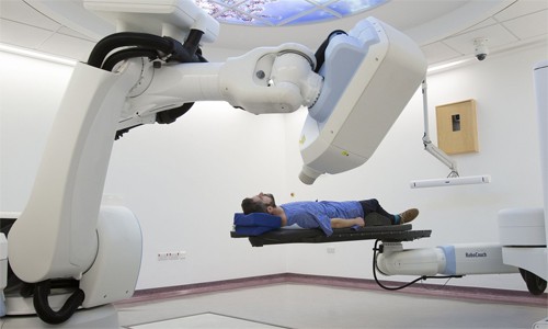 Prostate Cancer Radiotherapy