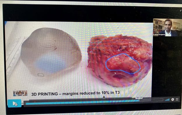 3D printed models