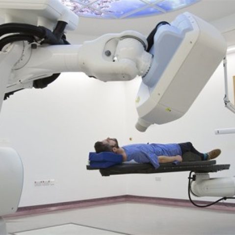 Prostate Cancer Radiotherapy